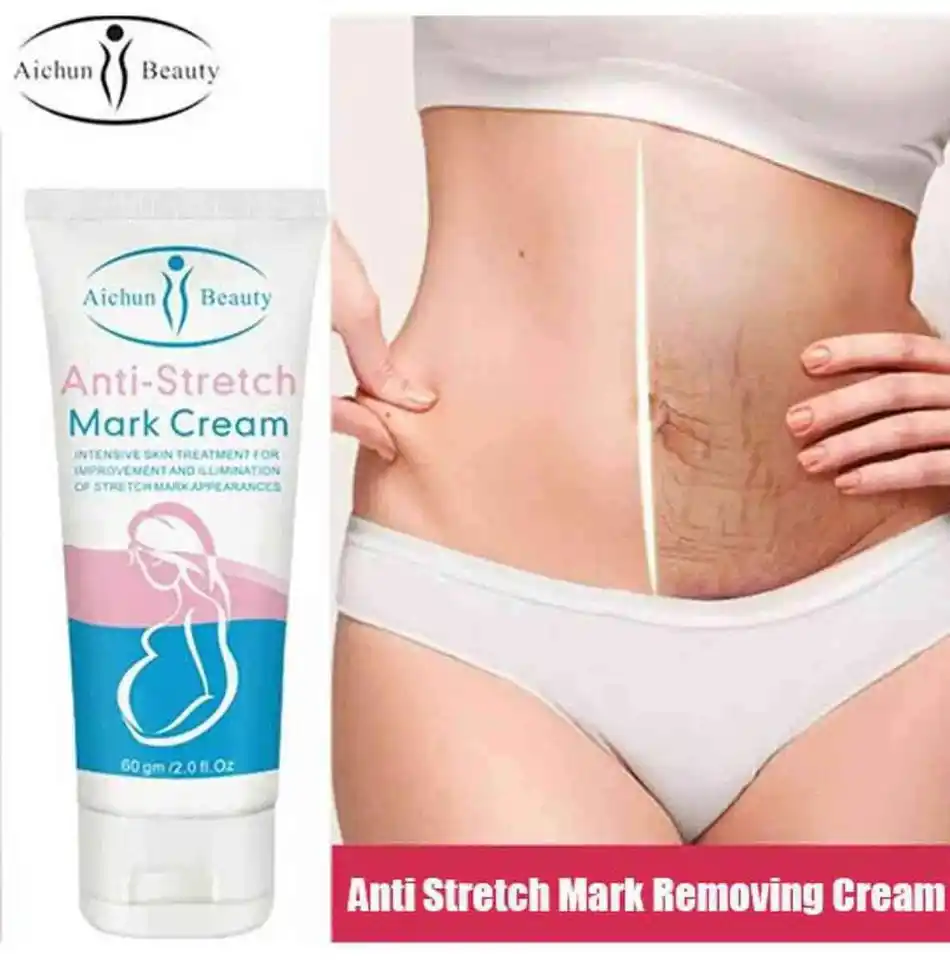 Aichun Beauty Anti Stretch Mark Cream - 60gm